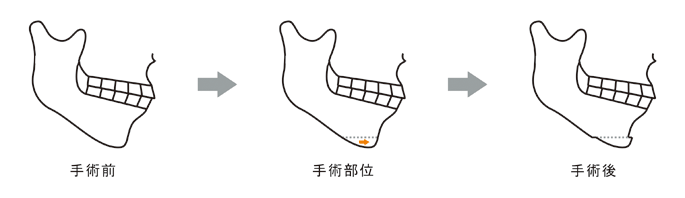 �I�g�K�C�`���p