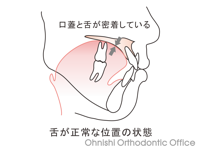 正常な舌位