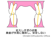 拡大しすぎの状態