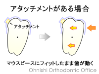 アタッチメントがある場合