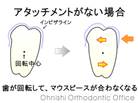 アタッチメントがない場合