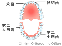 歯列弓