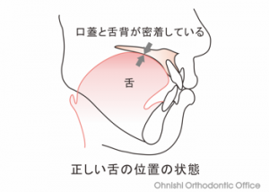 正しい舌位